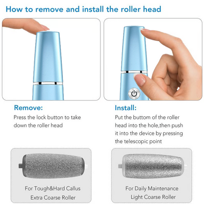 🔥Hot Sale 50% OFF!!⚡50K+ SOLD!❤️Electric Feet Callus Remover⚡