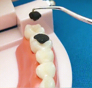 🏆German precision engineering! 0.1mm ultra-fine tip for precise flossing✨