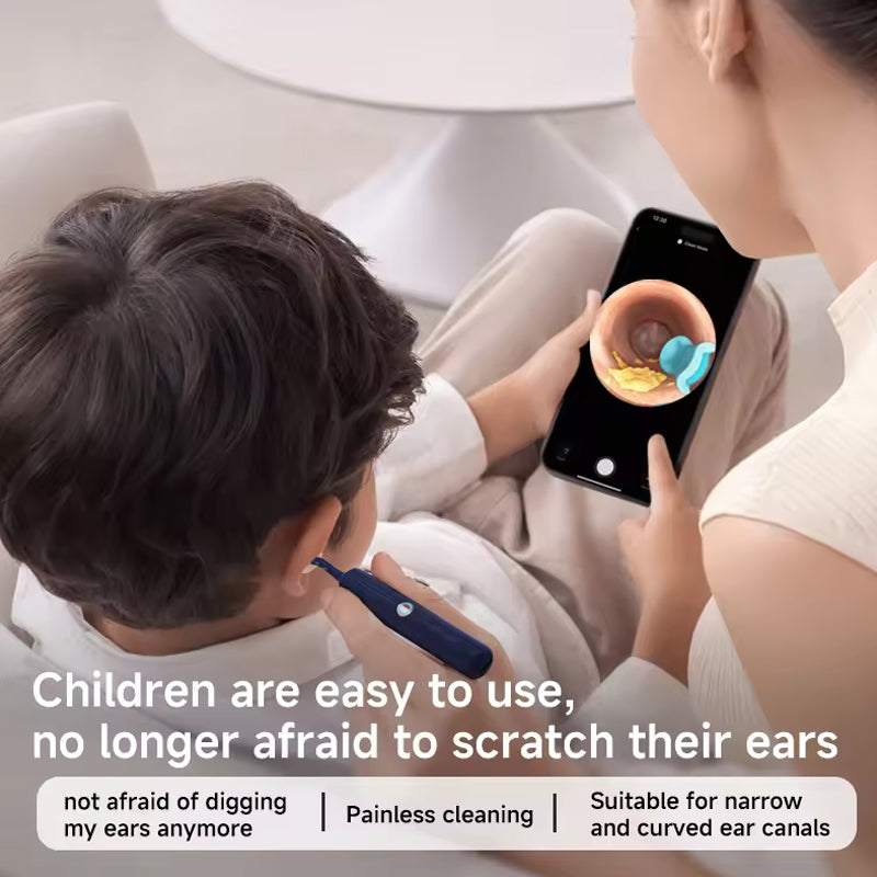 📣The safest tool for cleaning ears 😍 👂Visual Arc Ear Wax Removal Kit