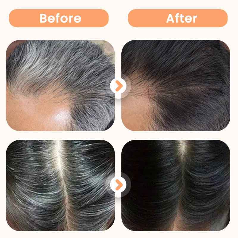 💆‍♀️🌿Plant Extract Hair Dye for Gray Hair