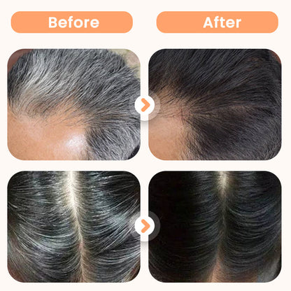 💆‍♀️🌿Plant Extract Hair Dye for Gray Hair