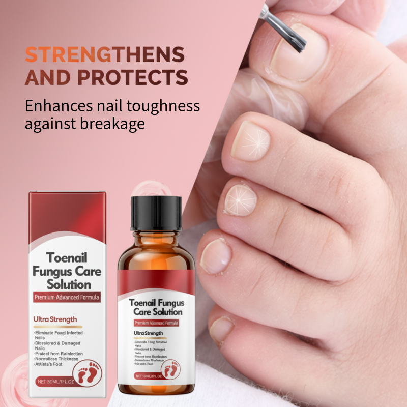 📢📢50 % OFF !!🎅Nail Repair Essence for Damaged Nails