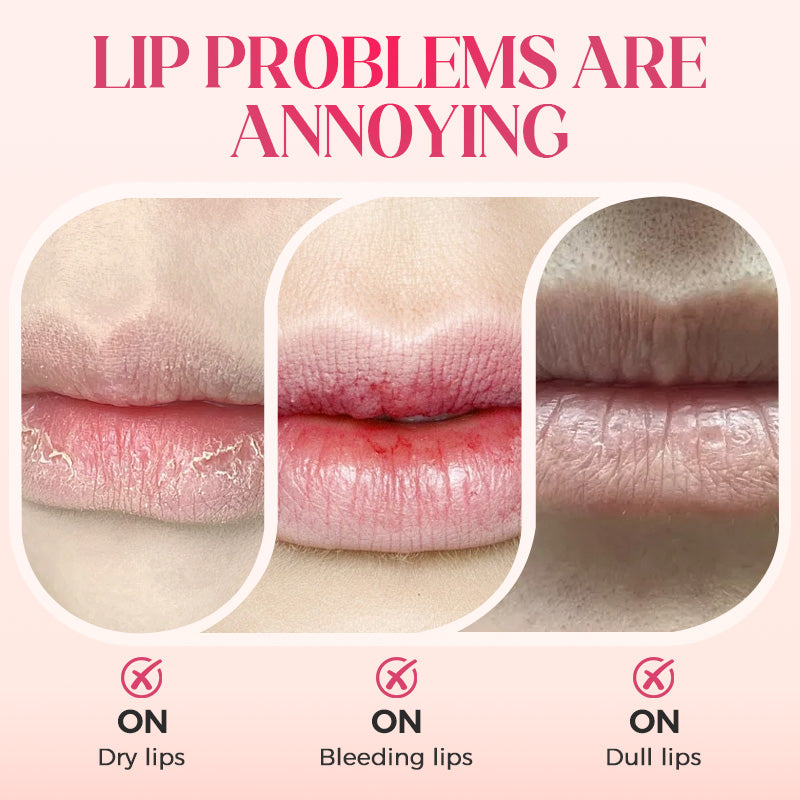 📢📢60%  OFF !! ⏰50K+ SOLD!✨Nooni Apple Hydrating Moisturizer Plump Transfer-proof Glossy Lip Stain Oil💋
