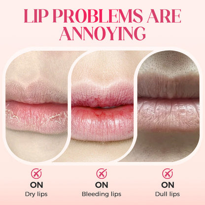 📢📢60%  OFF !! ⏰50K+ SOLD!✨Nooni Apple Hydrating Moisturizer Plump Transfer-proof Glossy Lip Stain Oil💋