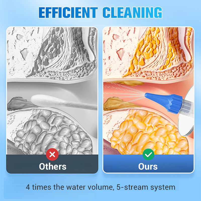 📢📢Big Sale Now On!⏰Ear Wax Removal Kit – Safe, Gentle & Reusable Silicone Spoon for Easy, Hygienic Ear Cleaning ✨🛡️